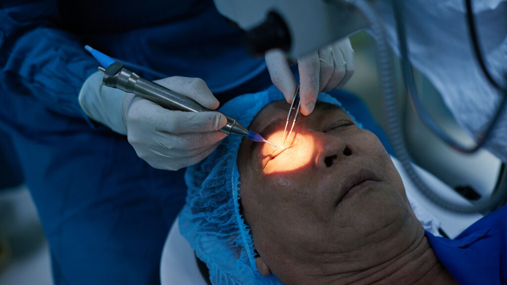 Glaucoma Surgery Training - Join Now – Seats Are Limited - caotacademy - egypt